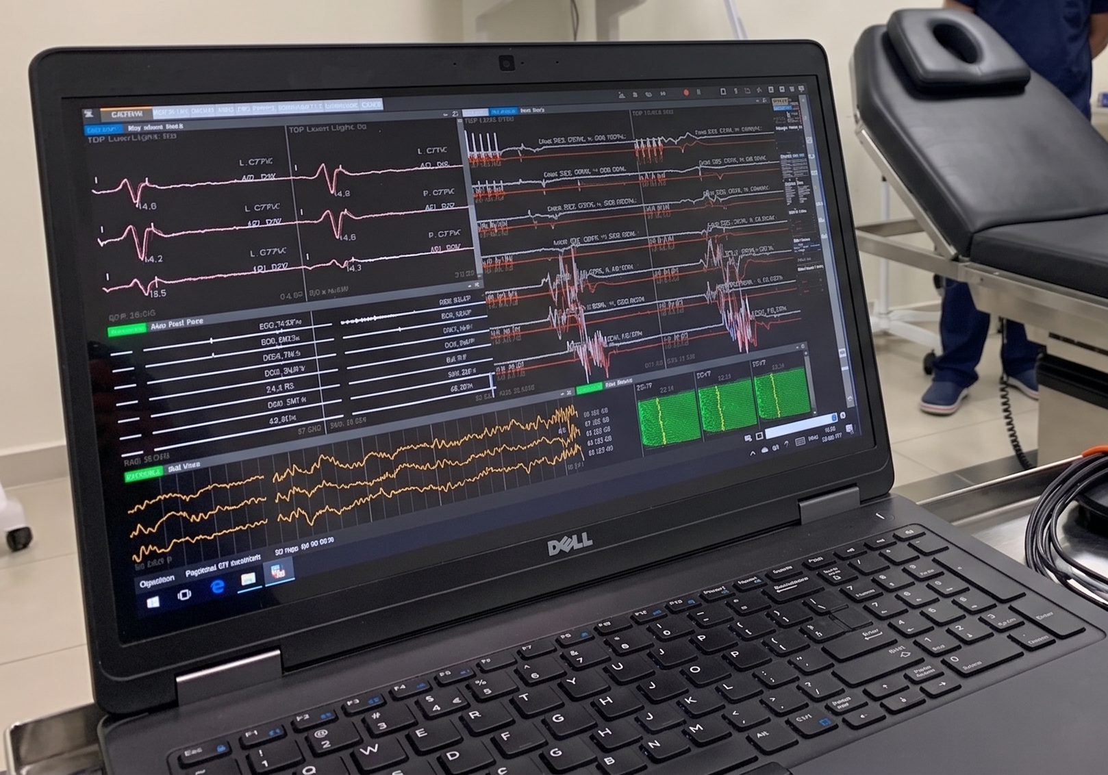 Proceso para coordinar neuromonitoreo intraoperatorio con Nervia