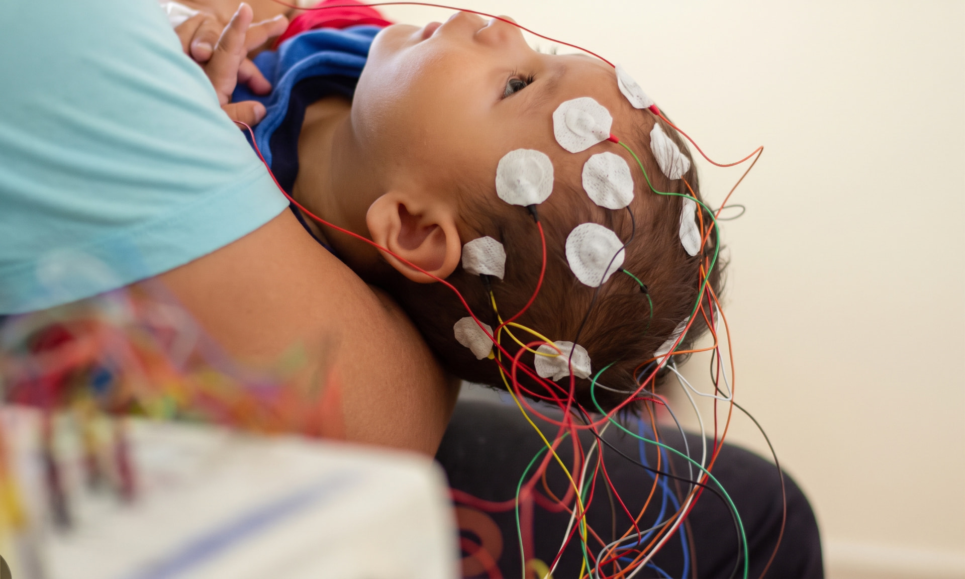 Electrodos de EEG colocados en el cuero cabelludo de un niño pequeño sostenido por un adulto